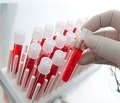Роль метаболитов оксида азота в формировании эндотелиальной дисфункции у детей с персистирующей бронхиальной астмой