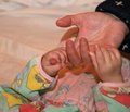 Новые возможности скрининга и диагностики различных проявлений туберкулезной инфекции у детей и подростков в России