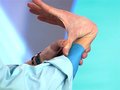 Расслаивающая аневризма аорты у ребенка с синдромом Марфана