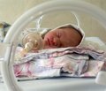 Характеристика стану легеневого кровообігу в недоношених новонароджених із різними типами респіраторної підтримки